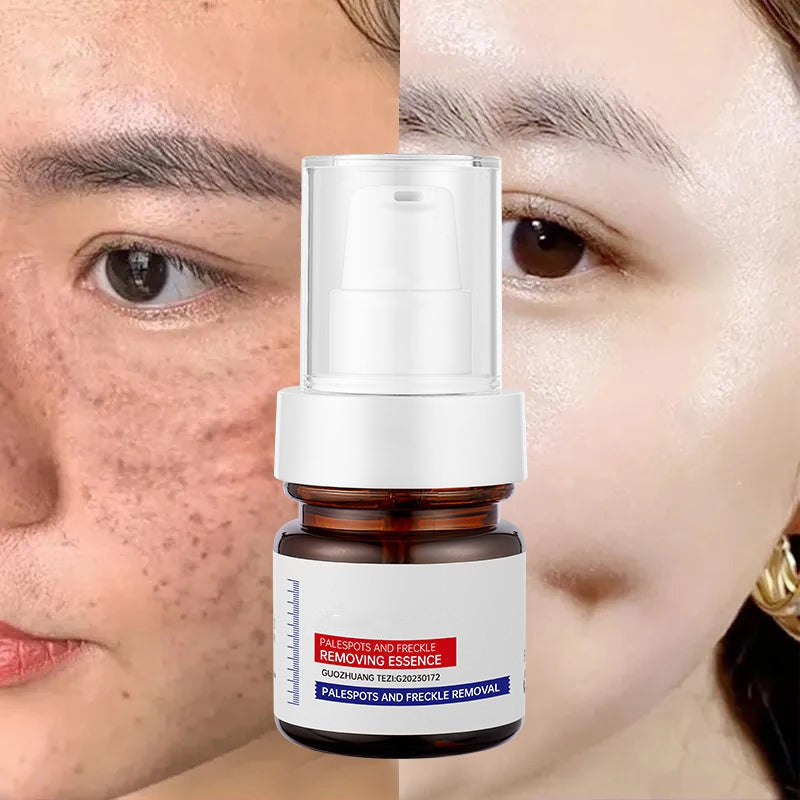 ⚡5-second brightening!Vitamin C Whitening Freckles ESSENCE