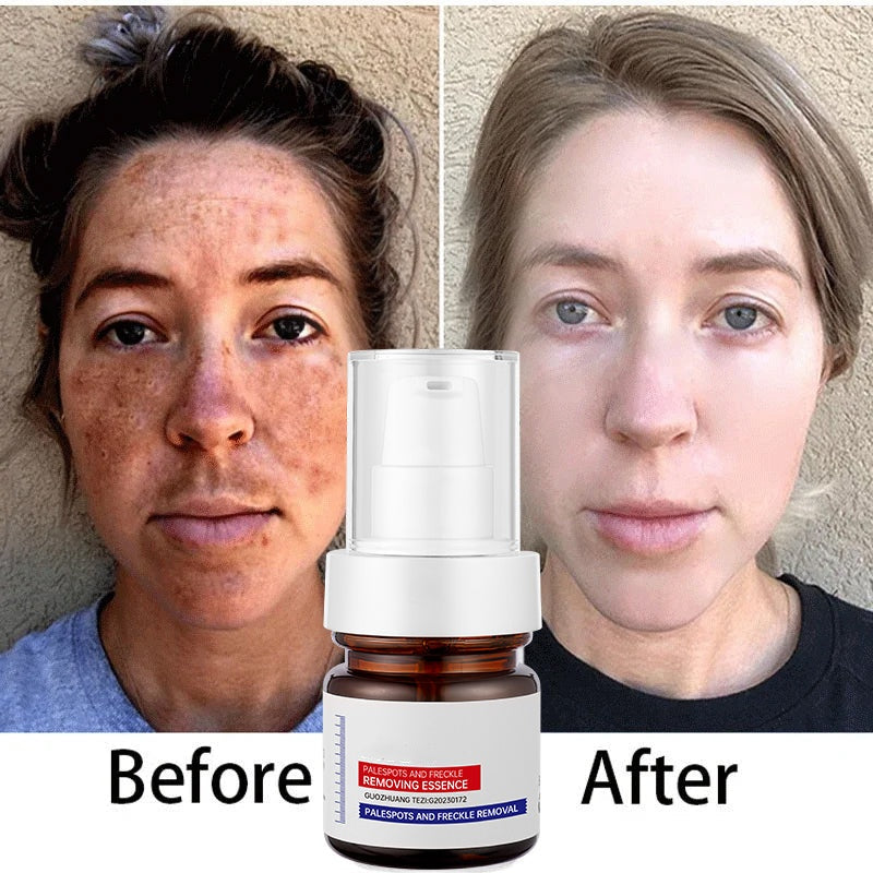 ⚡5-second brightening!Vitamin C Whitening Freckles ESSENCE