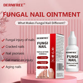 Toenail Fungus Treatment Extra Strength, Antifungal Solution for Toenail or Fingernail, Triple Action Formula for Remove Fungal, Repair and Renewal Damaged Nails, 0.5 Fl Oz