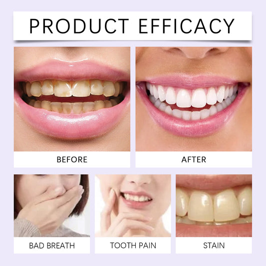 Whitening Strips – Teeth Whitening & Color Correcting Treatment