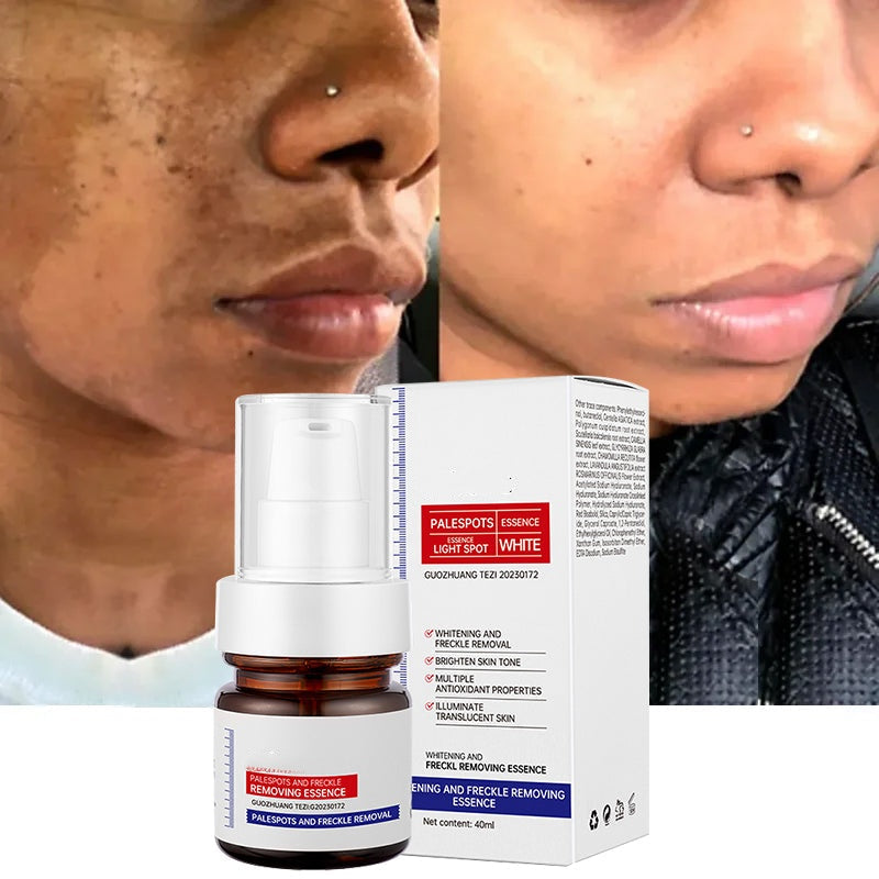 ⚡5-second brightening!Vitamin C Whitening Freckles ESSENCE