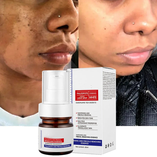 ⚡5-second brightening!Vitamin C Whitening Freckles ESSENCE
