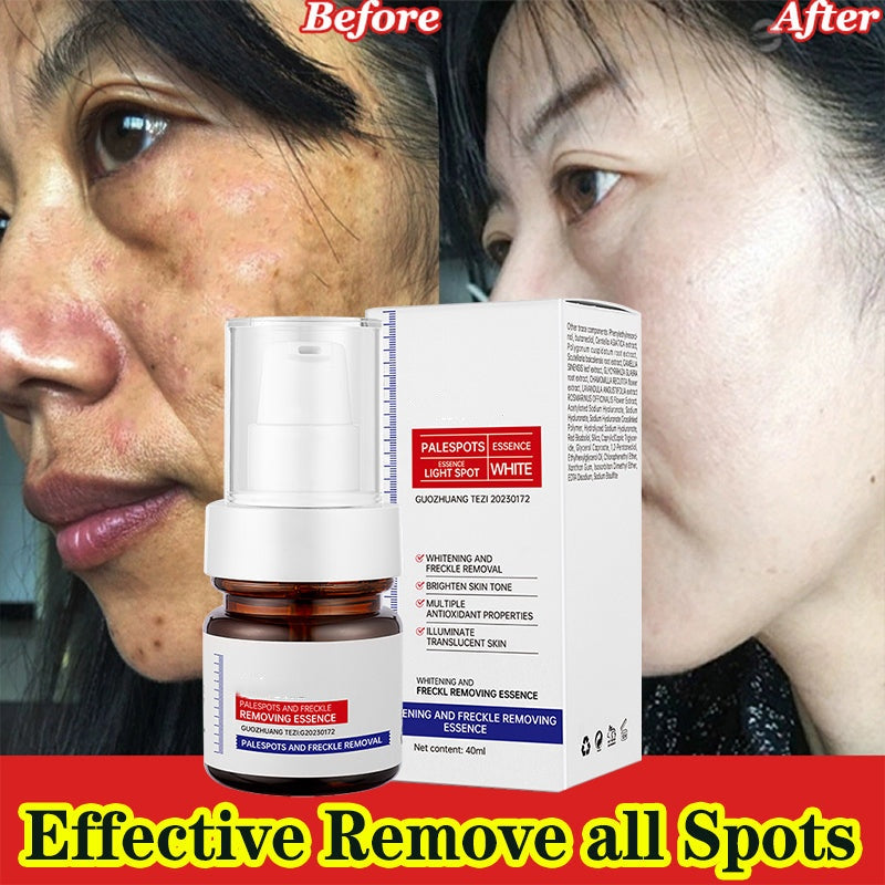 ⚡5-second brightening!Vitamin C Whitening Freckles ESSENCE