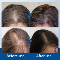 Advanced Hair Growth Roll-On Serum