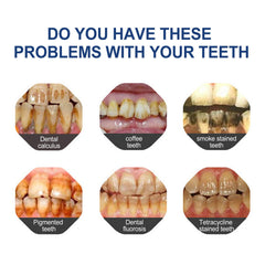 🔥Ends Tonight: Get 60% OFF Before It’s Gone!🎁 Fluoride-Free Hydroxyapatite Toothpaste – Gentle Whitening & Enamel Strength for Sensitive Teeth